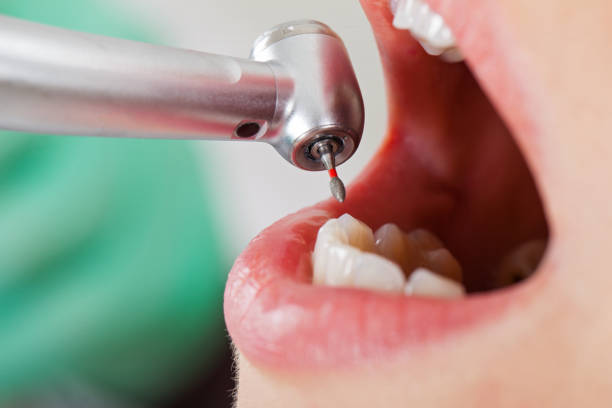 Best Knocked-Out Tooth Emergency  in Whitney, NV